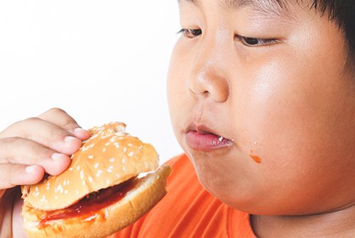 Childhood Obesity: Know All about Causes, Risk Factors, Prevention & Management